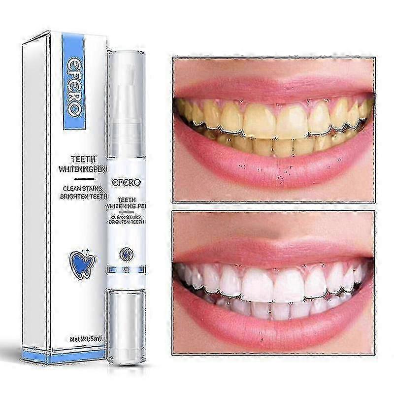 Effective Painless Tooth Bleaching Pen - Instant Bright Smile