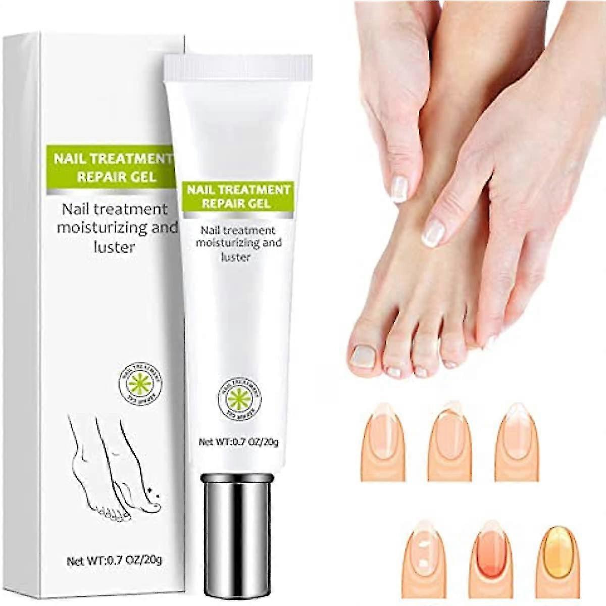 1/2/3 adet Tırnak Onarımı - Tırnak Tedavisi Onarım Jel Tırnak ve Ayak Tırnağı Tedavisi Tırnak Onarım Creamtoe Be Health Anında Güzellik Kremi Sarı Çatlak Yeniler