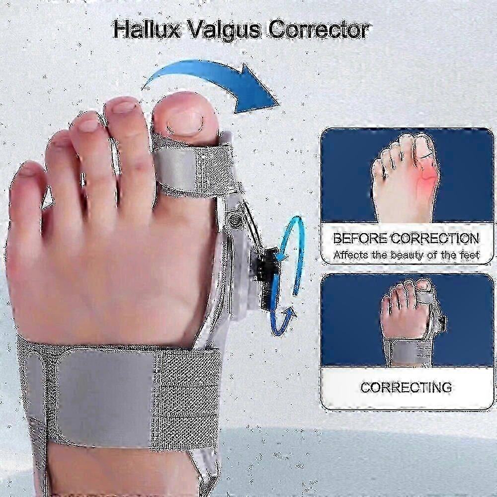 Bunion Fix Toe Valgus Corrector 2024 Edition