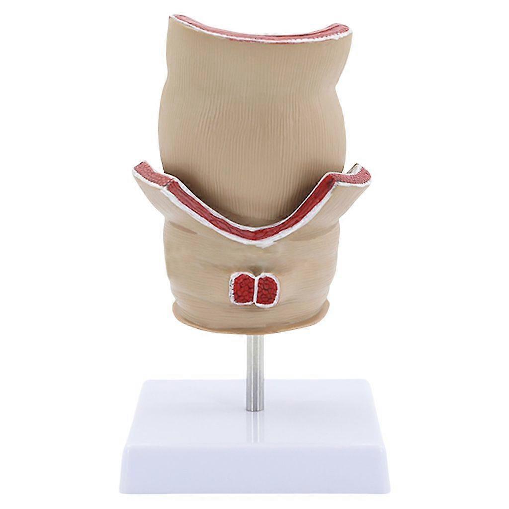 Human Rectum Model Pathologies of Rectum Model School Teaching Learning Tool