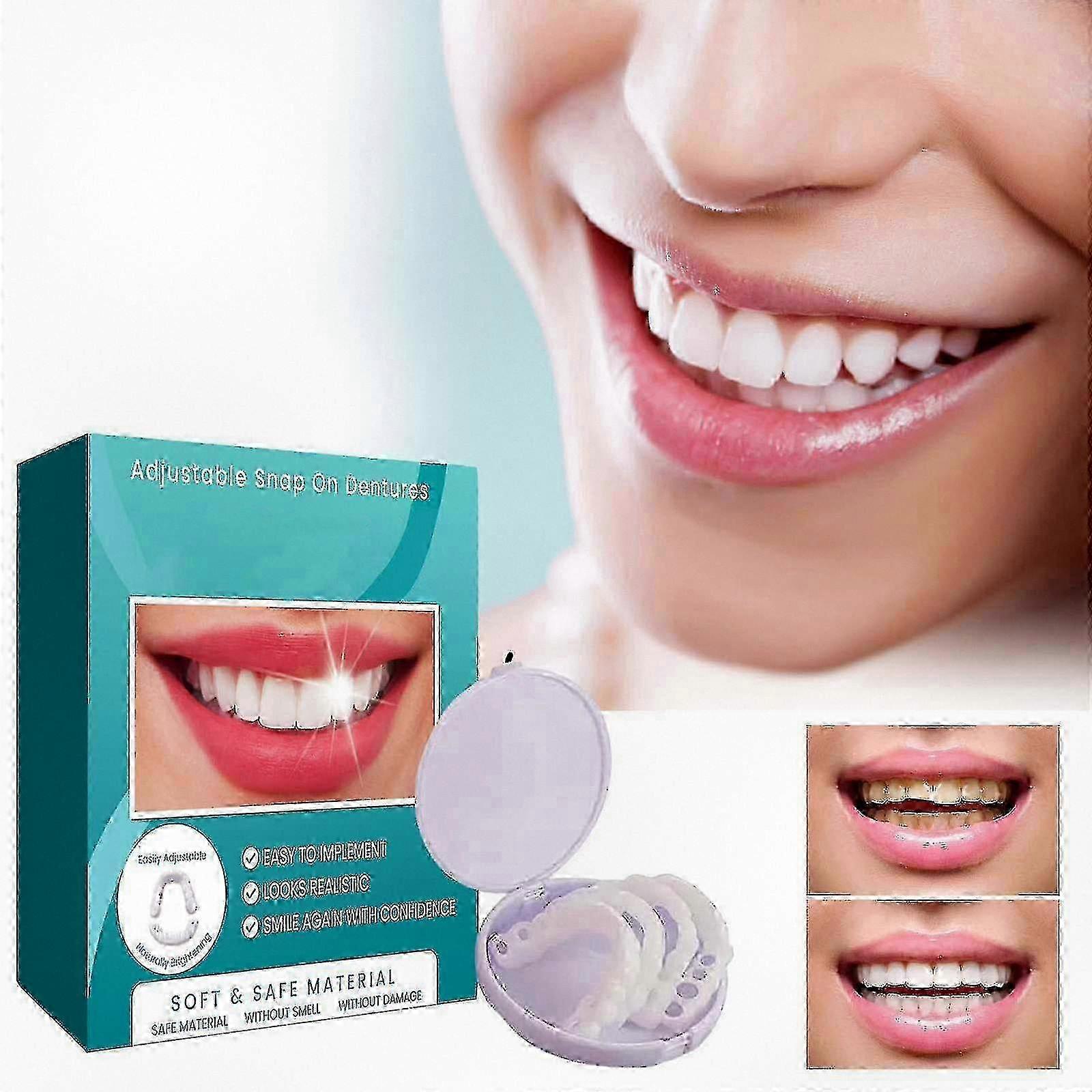 Snap-on Adjustable Denture Kit with Veneers, Braces, Cases & Temporary Interdental Fillings for Teeth Straightening