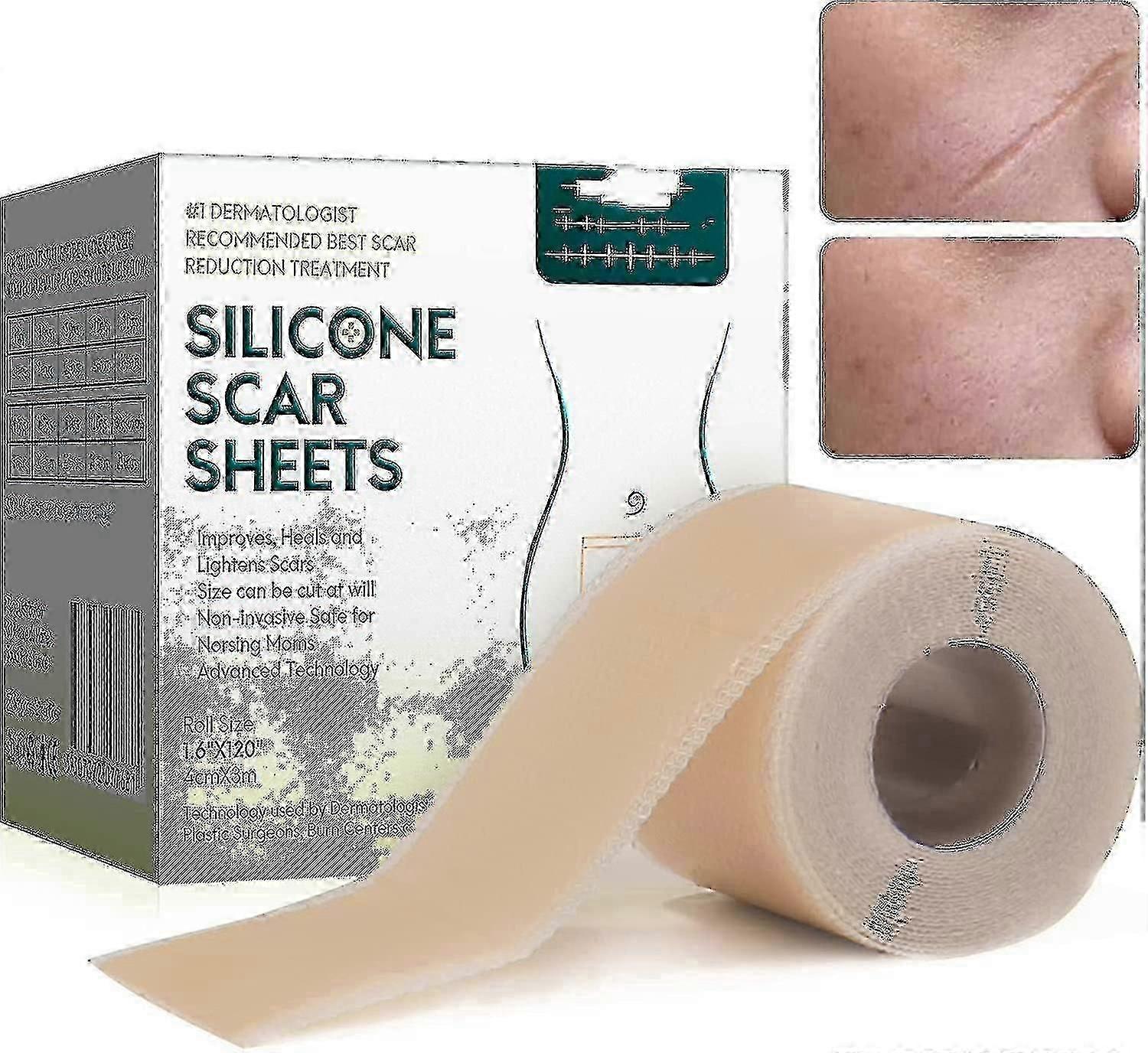 Silicone Scar Plasters for Surgery, C-Section, Keloids & Burns