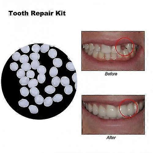 Protese Solid Lim Harpiks Protese Adhesive Teeth Restaurering Kit