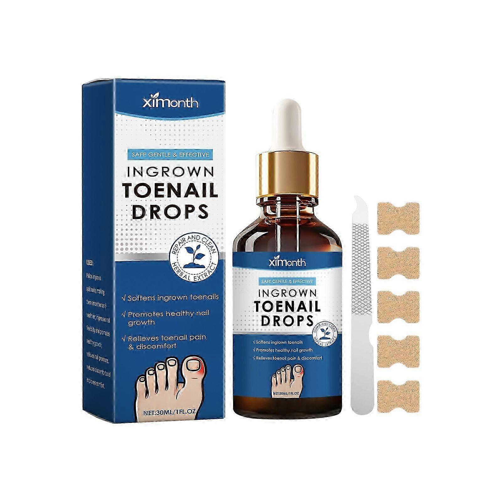30ml Gocce per unghie incarnite, trattamento per unghie incarnite, gocce per correttore unghie incarnite veloci ed efficaci, ammorbidente per unghie incarnite per unghie Easy Trimm