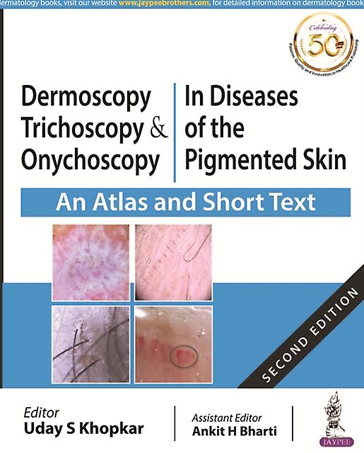 Dermoscopy Trichoscopy And Onychoscopy In Diseases Of The Pigmented Skin by Uday Khopkar Paperback Book