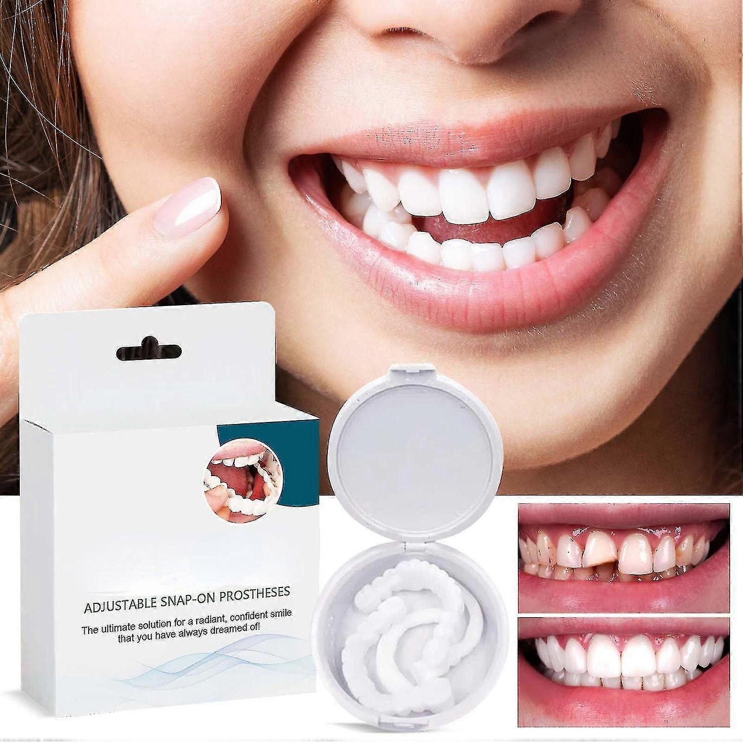 Adjustable Snap On Prothesens, Adjustable Snap On Denture, Silicone Whitening Denture Braces, Cover