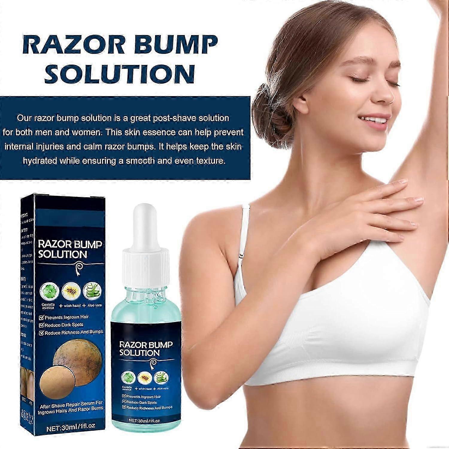 Razor Bumps Solution dla kobiet i mężczyzn, Leczenie wrastających włosów, Razor Bump Treatment na twarz, szyję, Po goleniu dla mężczyzn, Serum do wrastających włosów