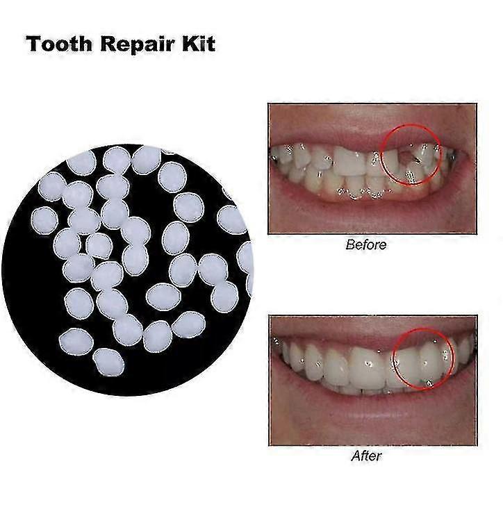10g/50g/100g Teeth And Gap Falseteeth Solid Glue Resin Denture Adhesive Teeth Dentist Falseteeth Solid Glue Temporary Tooth Repair Set