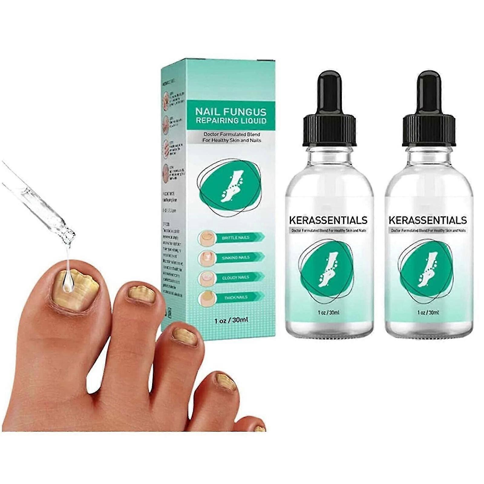 Kerassentials für Zehennagelpilz Kerassentials Zehennagelpilz Behandlung-Öl