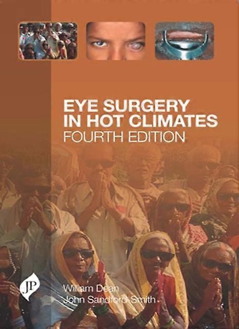 Eye Surgery In Hot Climates by John SandfordSmith Paperback