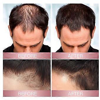 A1 3PC Rice Hair Spray Strengthens Hair, Moisturizes Scalp, Softens, Nourishes