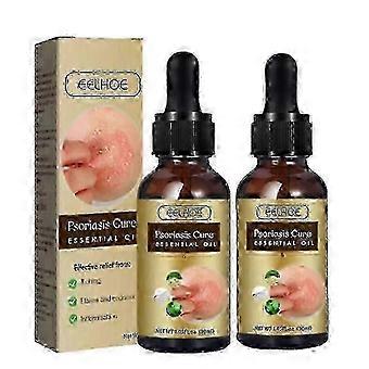 Tratamiento doble para la psoriasis y la caspa del cuero cabelludo. Aceite, antipicazón, estimulador folicular, hidratante, suavizante y nutritivo para el cabello. -NBB