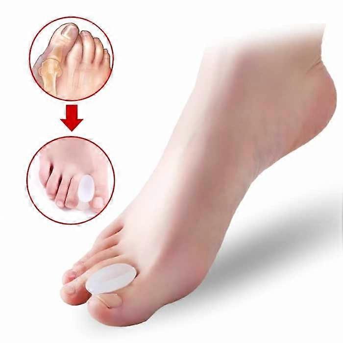 Hallux Valgus Διαχωριστής Μεγάλων Δακτύλων 2-pack