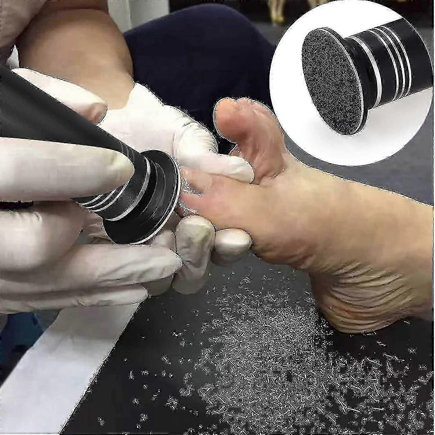 Speed adjustable callus remover for rough feet, 60 discs included