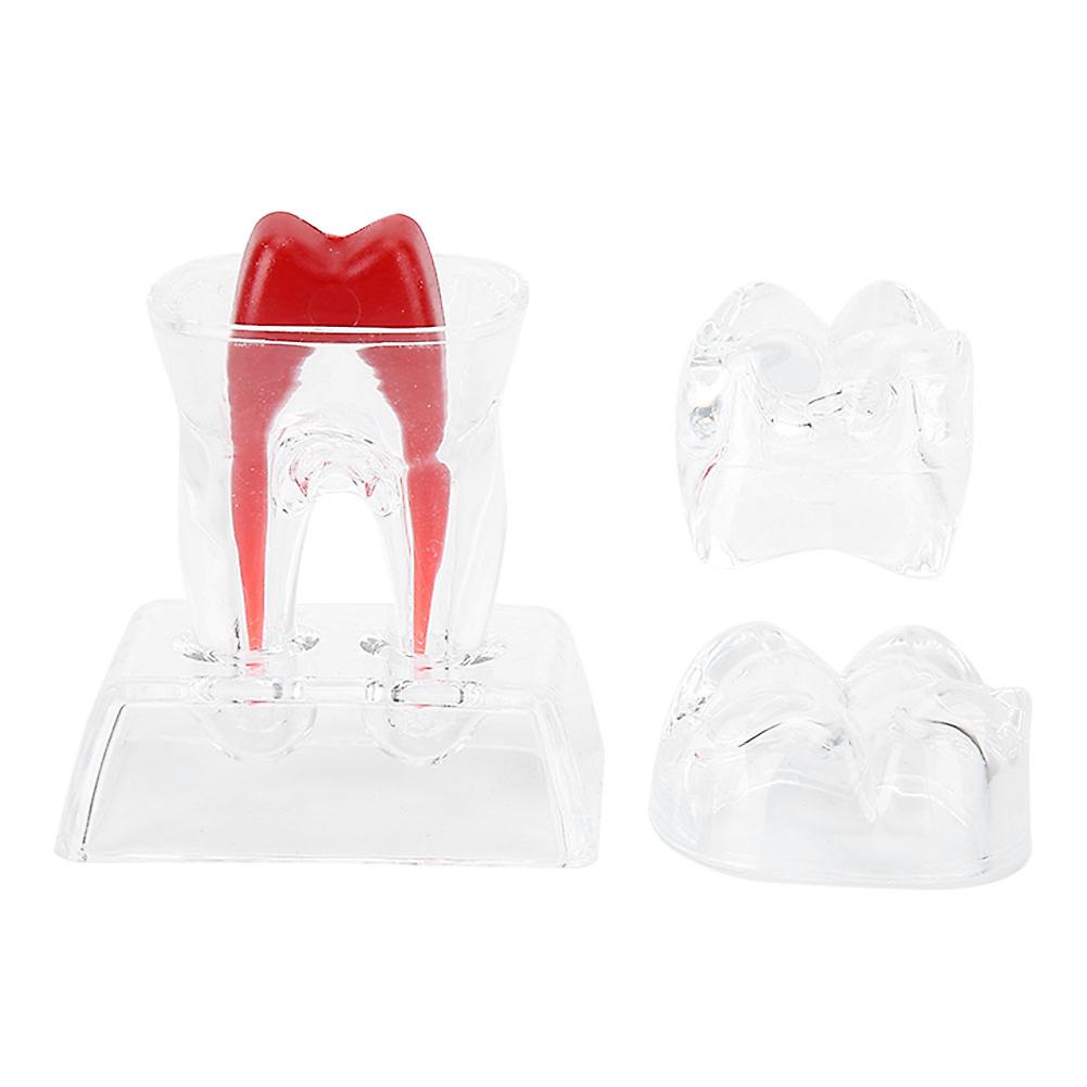 Teeth Model, Dental, Educational Tool, Plastic