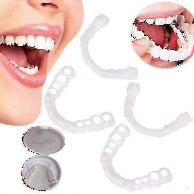 Zahnaufhellende, aufsteckbare Veneers (2er-Set)