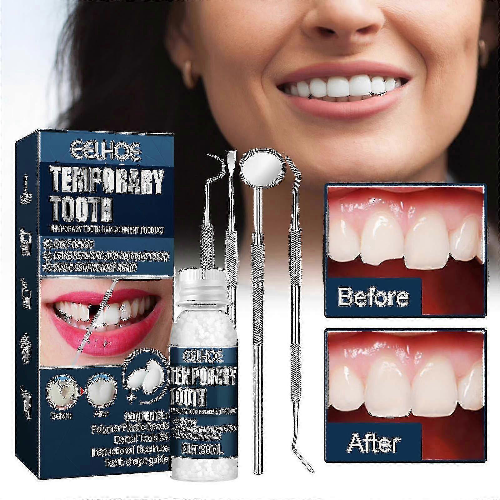 26-27 Temporary Tooth Repair Kit