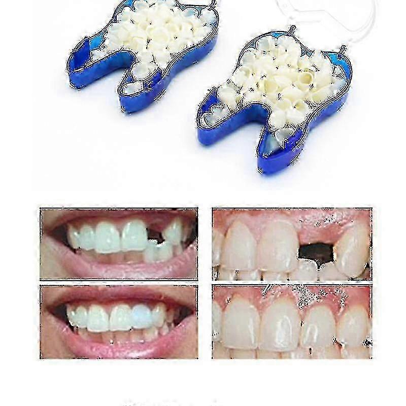 25-26 Adjustable Temporary Denture Braces for Missing & Broken Teeth, Secure Fit Upper Veneer Dentures Repair Kit