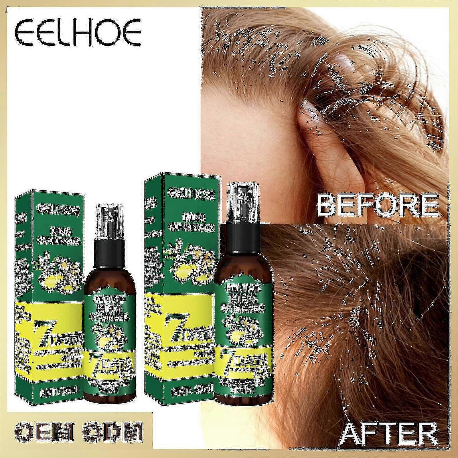 Ginger Spray Fluid pentru creșterea părului Întărirea părului Masaj Repararea deteriorării scalpului Hrănitor F