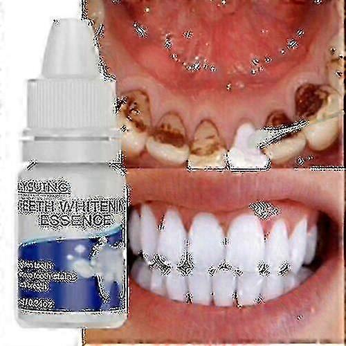 新しい歯のホワイトニングエッセンスエクストラストロングホワイトハイジーン歯のホワイトニングナー汚れ除去口腔衛生ホワイトニングジェル歯垢と汚れのクリーニングTWを取り除く--