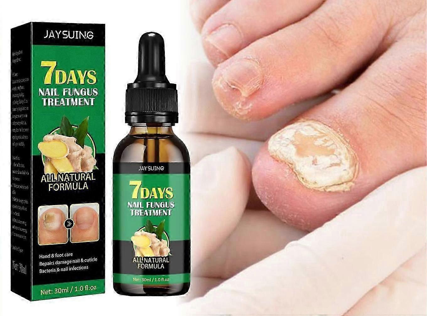 علاج فطر الأظافر لمدة 7 أيام ، 7 أيام لنمو الأظافر وتقوية الأظافر ، حل إصلاح الأظافر بقوة إضافية لأظافر صحية ، Happy H