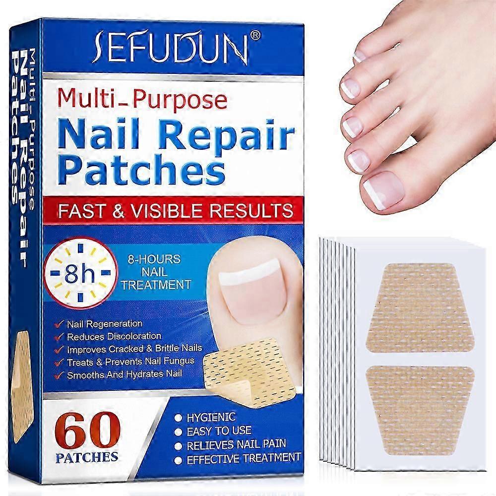 SEFUDUN Nail Repair Patch Embedded Toenail Corrector Toenail Patch 60 Pieces 1