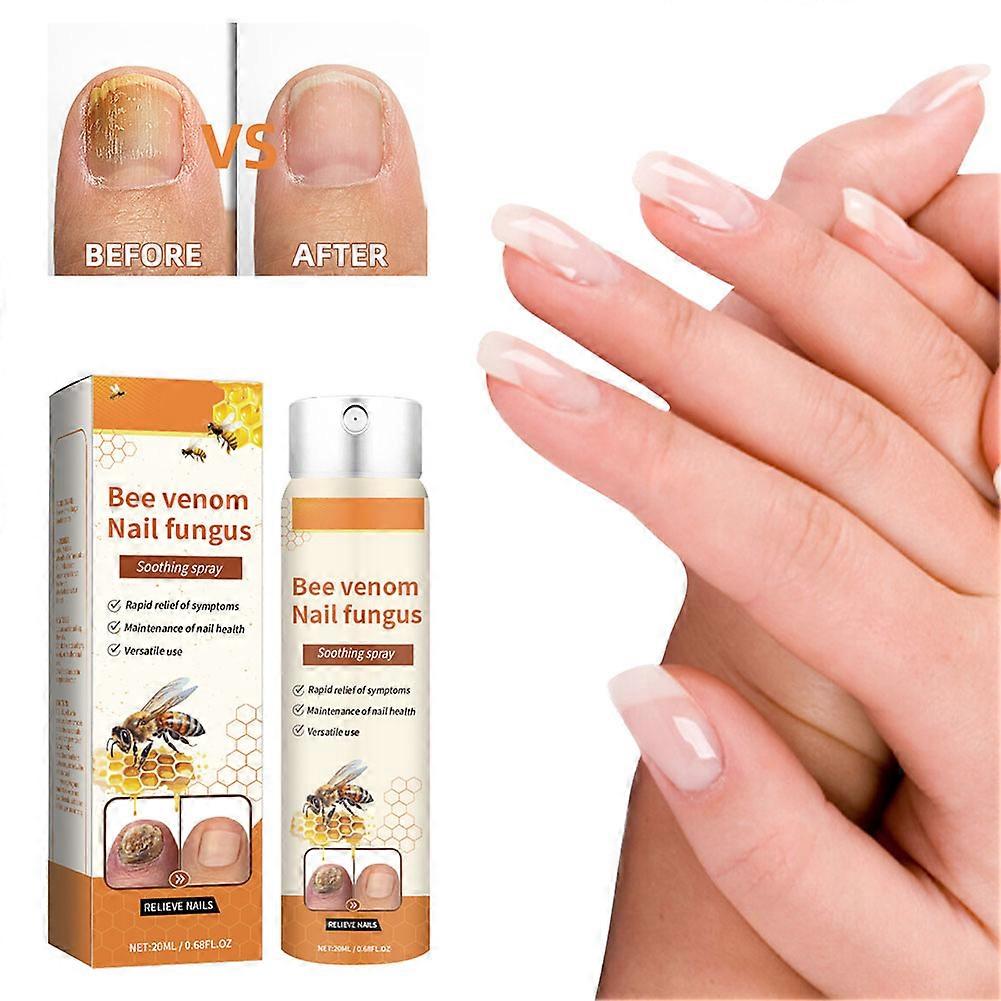 Bee-Venom Nail Fungus Soothing Spray - Natural Anti-Fungal Treatment for Toenails & Fingernails, Gentle, Effective Care for Men and Women