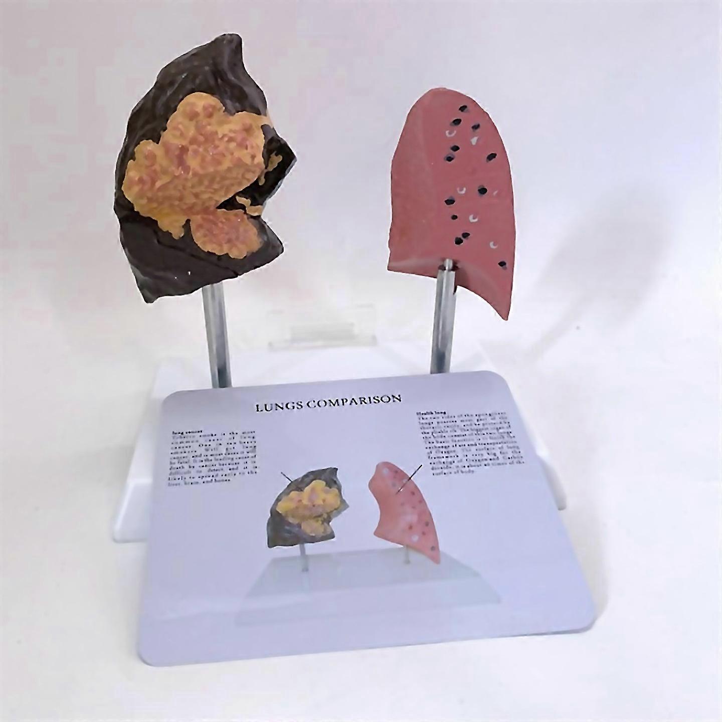 For Smokers Lung Model Healthy Lung Model Lung Anatomy Model