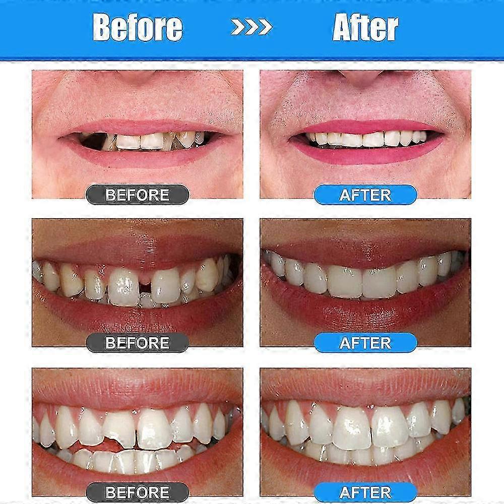 1/2/3pcs Moldable Tooth Replacements Kit for Fixing,Dental Care Kit Tooth Repair Kit