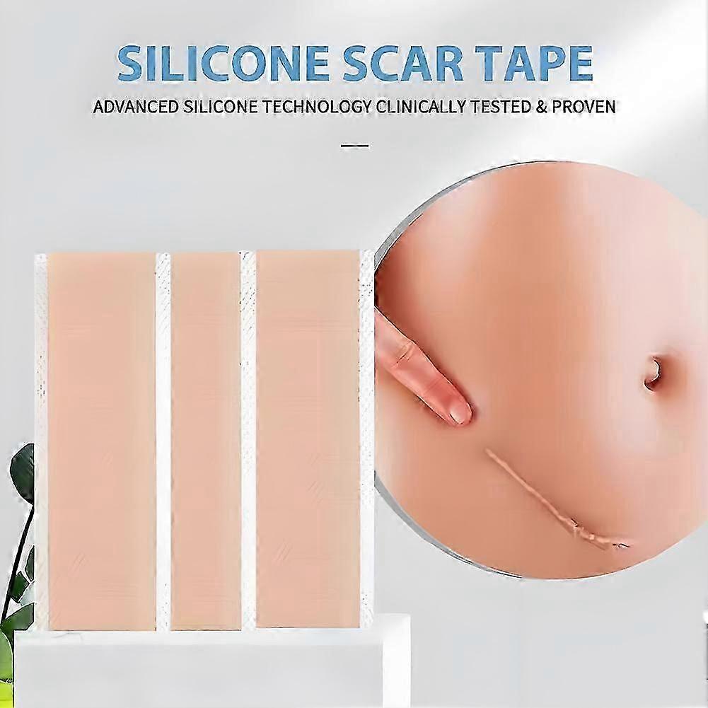 4 * 15cm(A)$Silicone二重まぶたの傷跡、目に見えない帝王切開の肌の色防水にきび傷跡ステッカーのためのゲル傷跡ステッカー