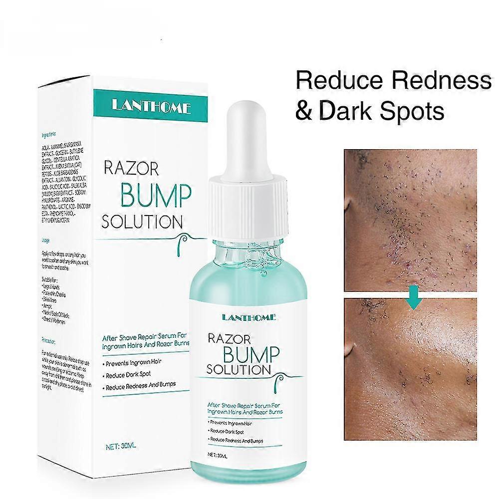 Razor Bump Plug After Shave Hair Growth Treatment Reduces Dark Spots Redness Razor Burn Men And Women