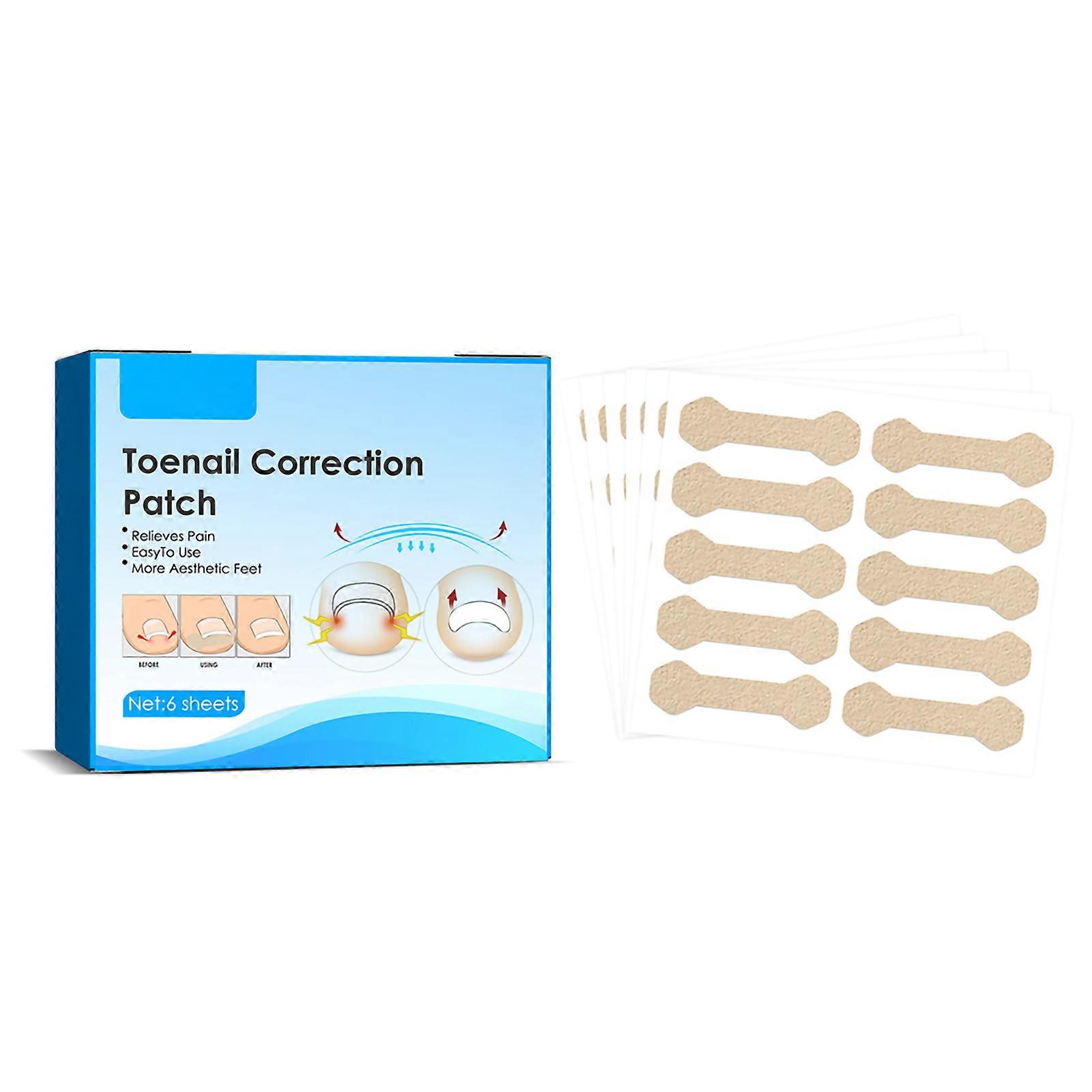 Ingrown Toenail Corrector Stickers Toenail Corrector Patch Nail Correction Tool Nail Corrector Patch Pedicure Tools