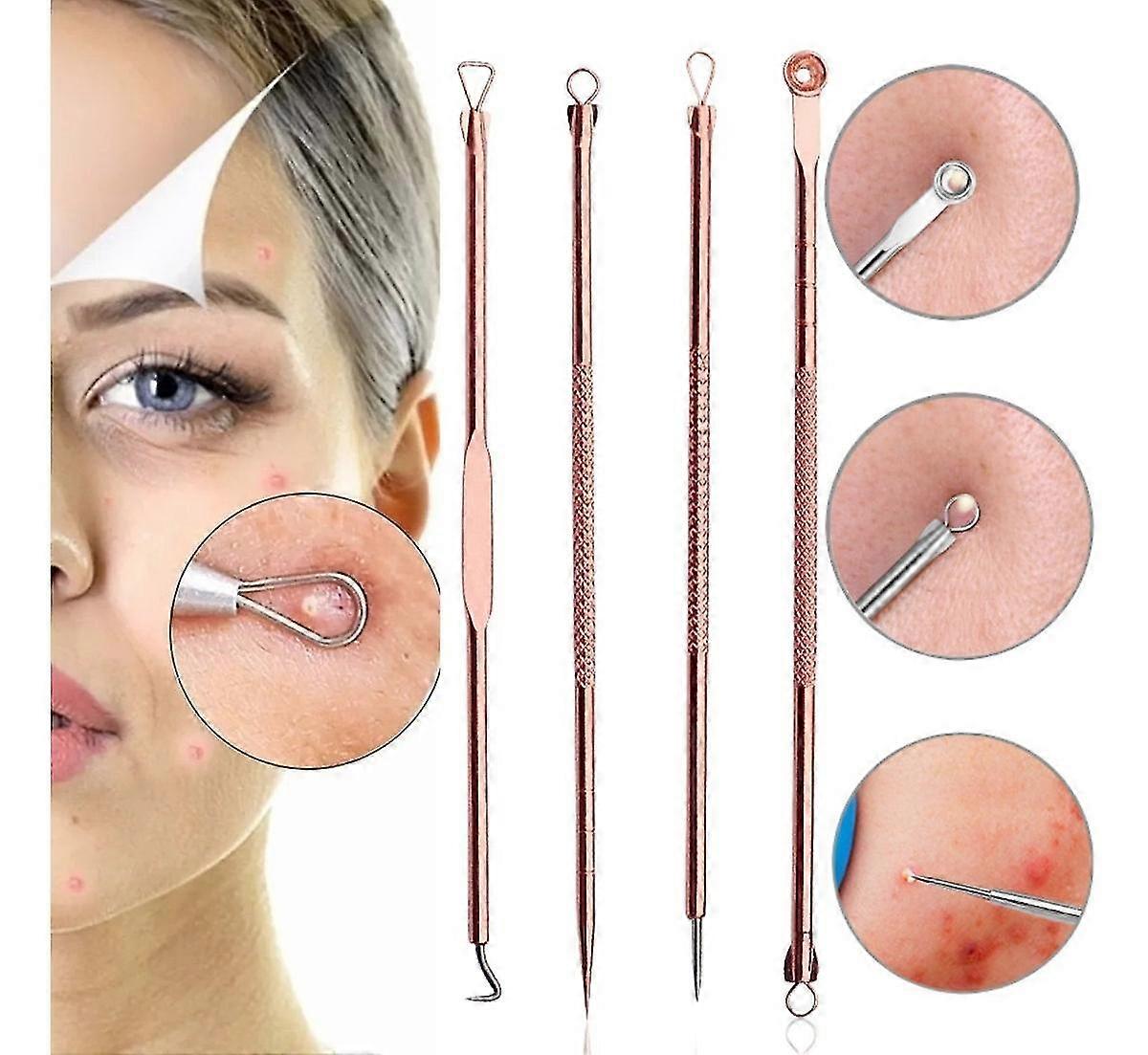 Makeup Remover Set Acne Needle Set Acne Squeezing Tool Set (rose Gold) (4pcs)
