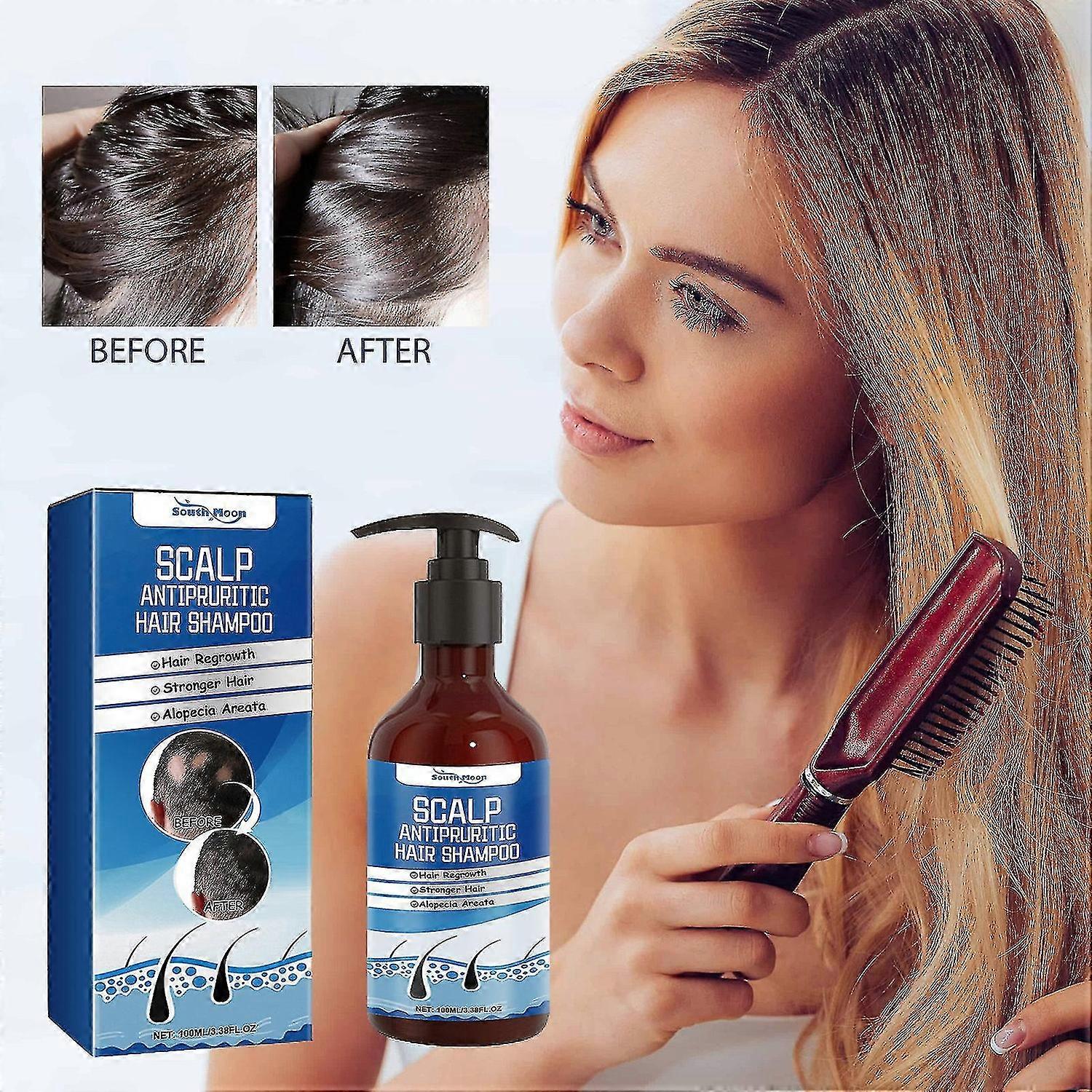 Scalp Anti-Dandruff and Antifungal Shampoo - Treats Folliculitis, Seborrheic Dermatitis