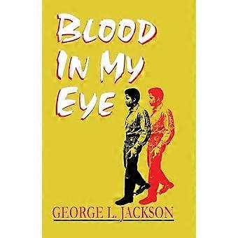Blut in meinem Auge