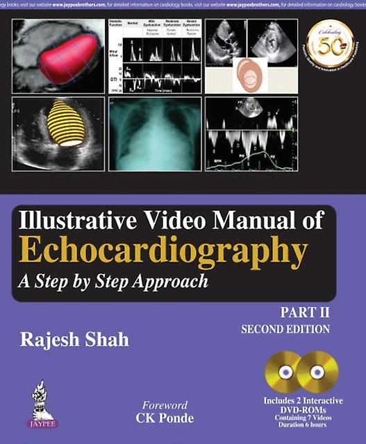 Illustrative Video Manual Of Echocardiography by Rajesh Shah Hardback Book