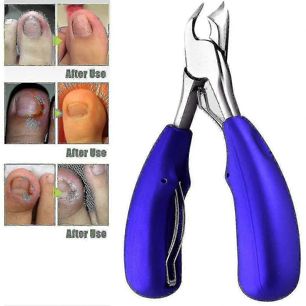 Professional Toenail Clippers For Thick Or Ingrown Toenails - Precision Nail Clippers With Straight Lines