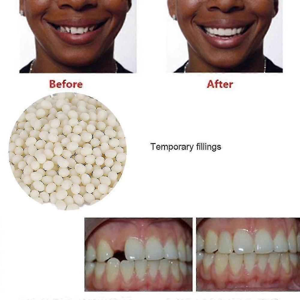 Temporary Tooth Repair, Gaps Filling Denture Adhesive False Teeth Solid Glue