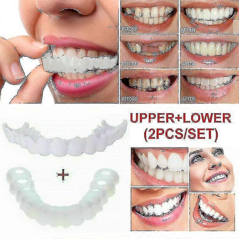 Snap On False Teeth Upper + Lower Dental Veneers Dentures Tooth Cover Set A