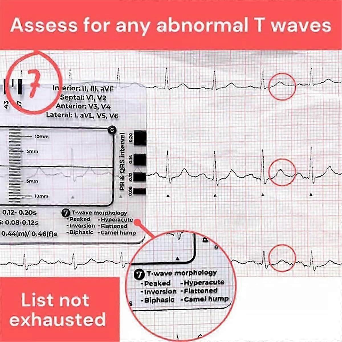 Righello ECG a 7 passi, righello ECG, strumento di misurazione del righello in plastica, righello ECG a 7 passi compatibile con ECG/ECG Interpretati