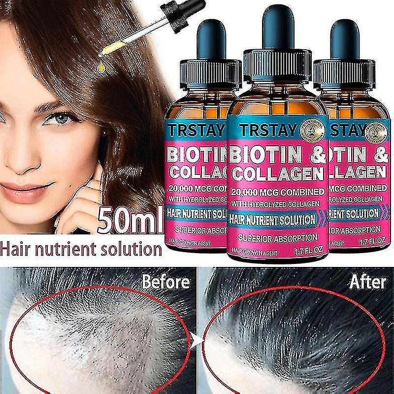 Τριχόπτωση αλωπεκία για τις γυναίκες Oil Care