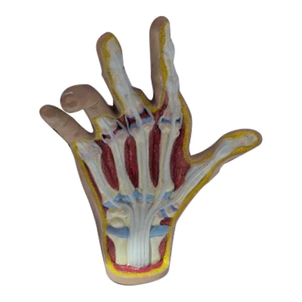 Osteoarthritis Hand Model, Model of Hand Pathology, Human Anatomy and Physiology Replica, Doctor'S