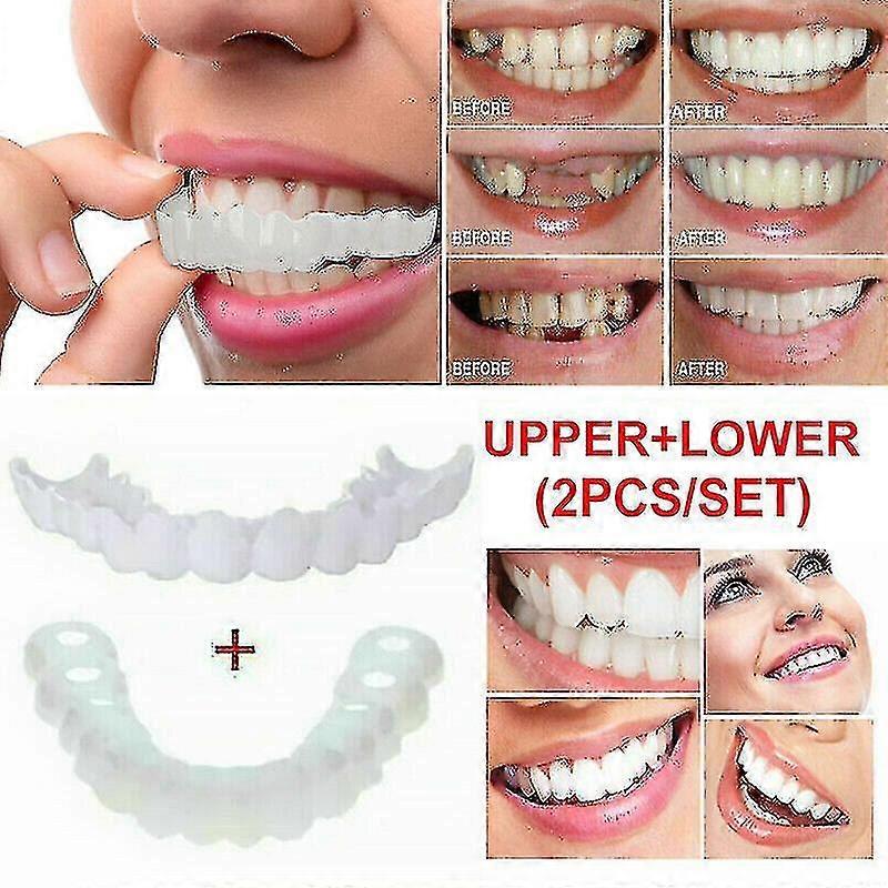 Snap On False Teeth Upper + Lower Dental Veneers Dentures Tooth Cover Set A