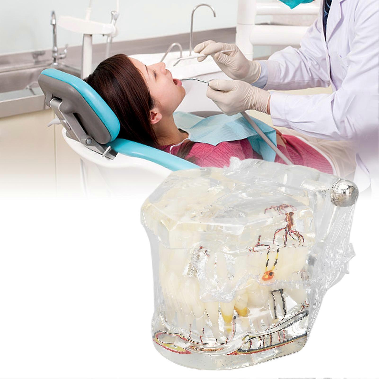 Portable Transparent Disease Teeth Model for Dental Teaching