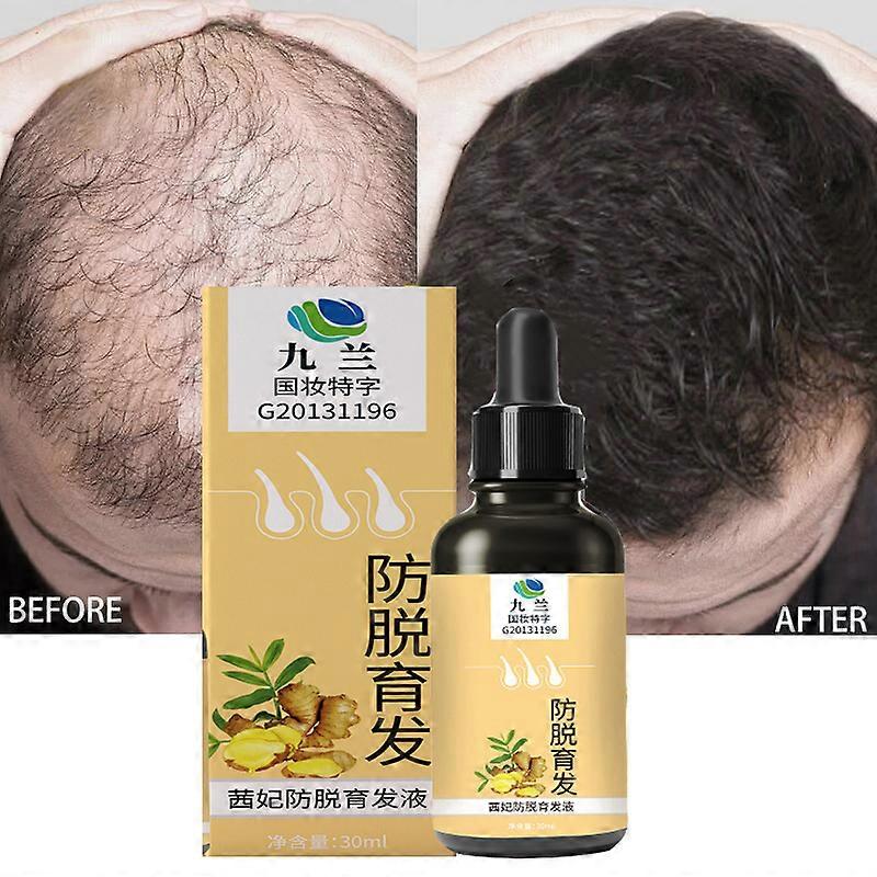 מוצרי צמיחת שיער ג'ינג'ר גדל במהירות שיער שמן אתרי יופי טיפוח שיער למנוע נשירת שיער שמן קרקפת טיפול לגברים נשים