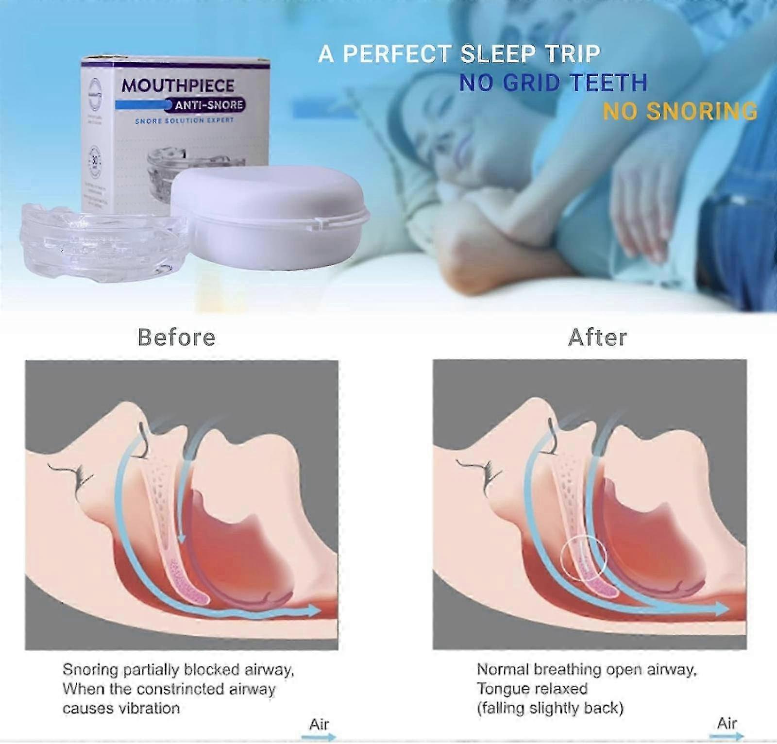 2025 Anti-snoring devices, adjustable anti-snoring devices, snoring aids for men and women, anti-snoring aids for comfortable sleep and anti-snoring -