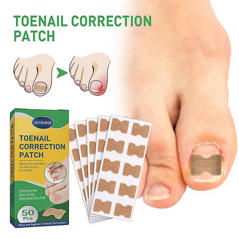 50pcs Toenail Corrector Pedicure Patch Ingrown Toe Nail Correction Sticker