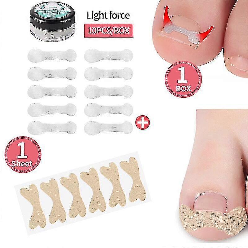 4-20pcs爪矯正ステッカー爪周囲炎治療陥入爪矯正弾性矯正クリップブレースペディキュアツール