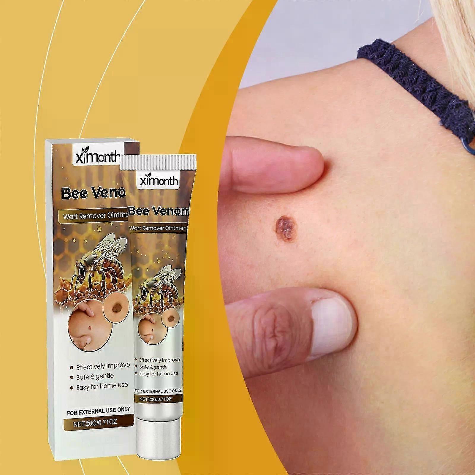 ビーヴェノムクリーム、ビーヴェノムリペアクリーム、ビーヴェノムアンチワートセラム、アドバンスワートリペアクリームビーヴェノムクリーム 肌の傷を減らす