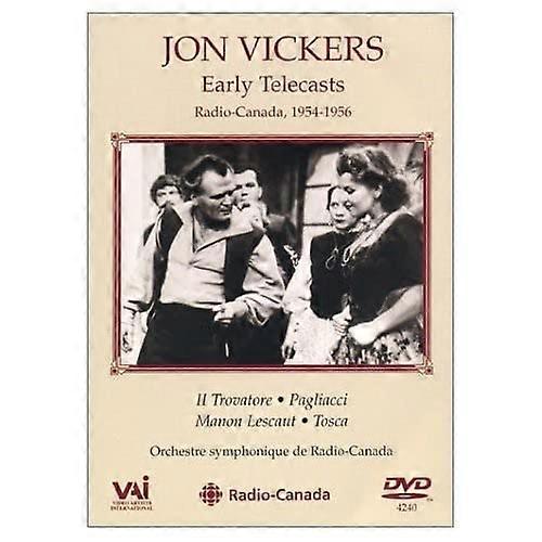 Vickers:Early Telecasts [DVD]